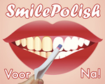 SmilePolish®, mooi & gezond, schoonheid, Met spectaculair schone tanden is uw lach zoveel aantrekkelijker
